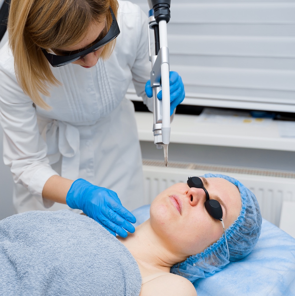 Laser Treatments Services